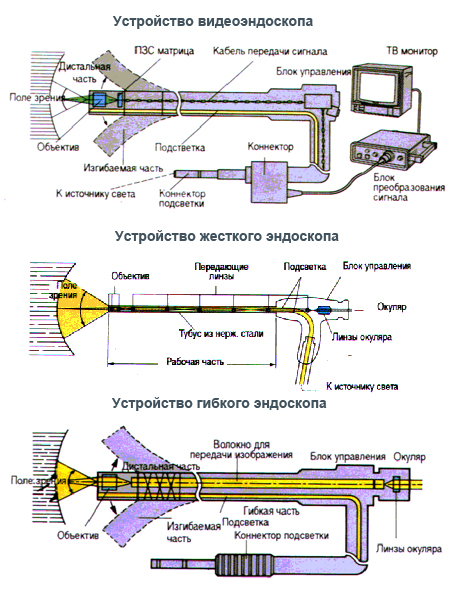 Различия систем
